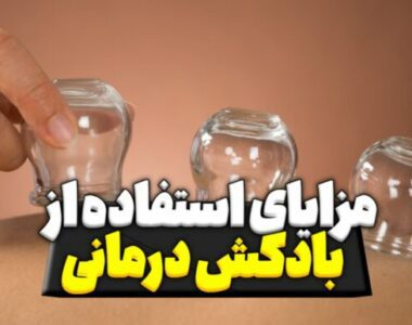 مزایای استفاده از بادکش درمانی مزایای استفاده از بادکش درمانی