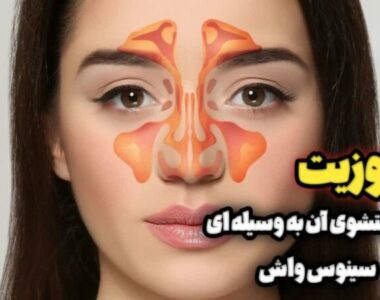 نشانه های سینوزیت شستشوی آن به وسیله ی سینوس واش