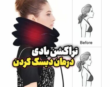 درمان گردن درد با روش ترکشن گردن